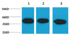 β III tubulin Mouse mAb