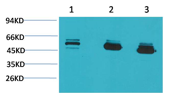 CBARA1/MICU1 Mouse mAb 50µL/100µL