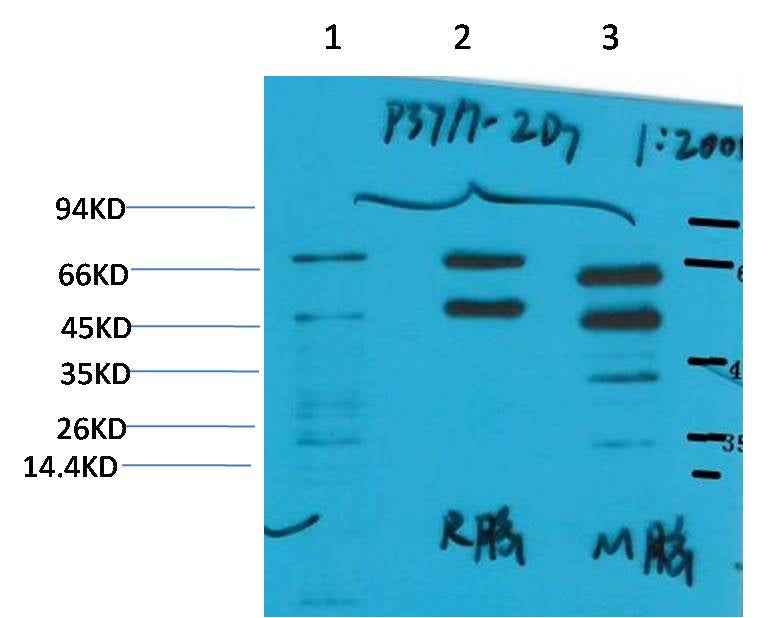 Phosphoserine Mouse mAb