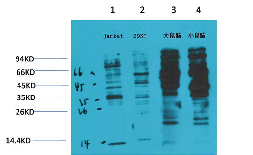 Phosphotyrosine Mouse mAb 50µL/100µL