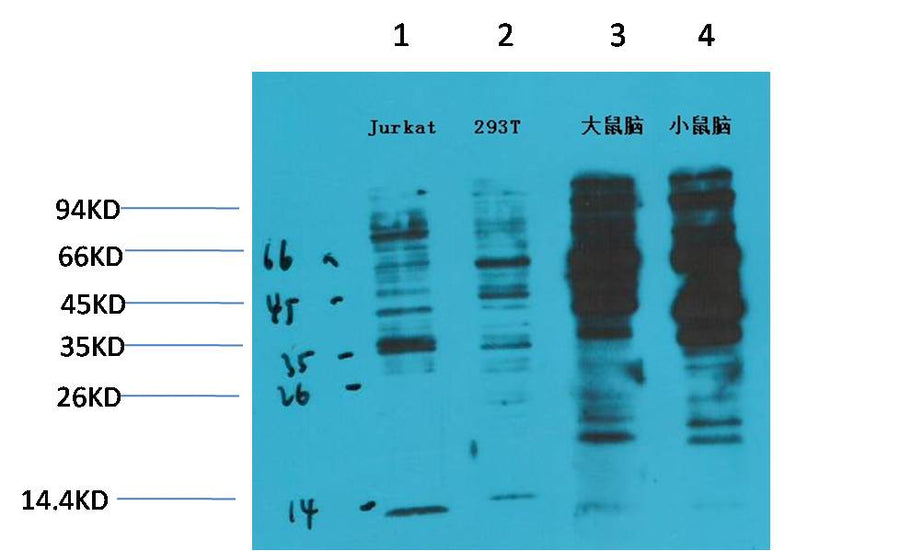 Phosphotyrosine Mouse mAb 50µL/100µL