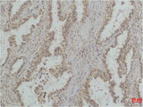 P53(Mono Methyl Lys370) Mouse mAb