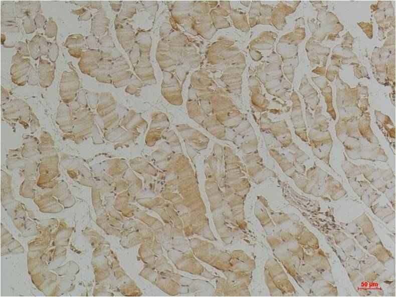 Desmin Mouse mAb