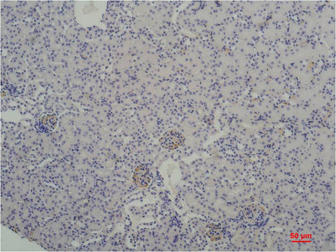 TBP/TATA Binding Protein Mouse mAb 50µL/100µL
