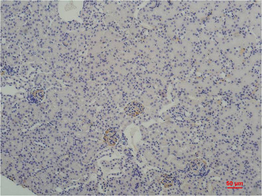 TBP/TATA Binding Protein Mouse mAb 50µL/100µL