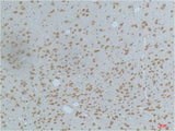 CaMKIIβ/γ/δ (Phospho Thr287) Mouse mAb