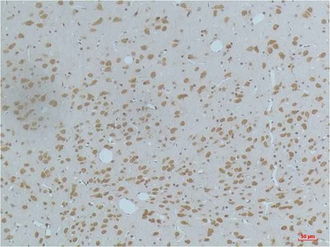 CaMKIIβ/γ/δ (Phospho Thr287) Mouse mAb