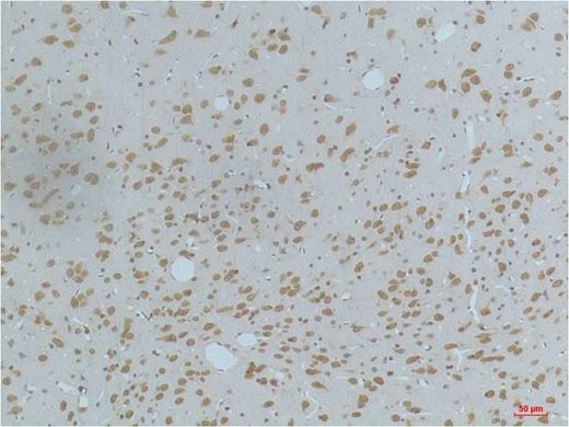 CaMKIIβ/γ/δ (Phospho Thr287) Mouse mAb