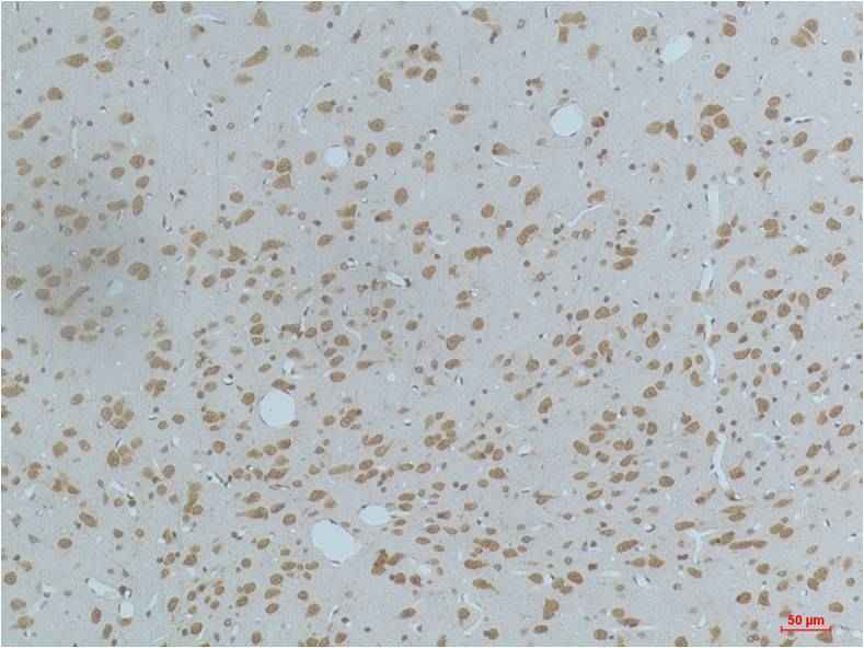 CaMKIIβ/γ/δ (Phospho Thr287) Mouse mAb
