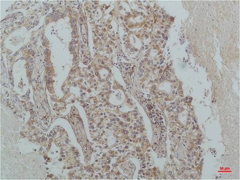 IκB β Mouse mAb 50µL/100µL
