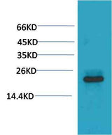 HSPB8/HSP22 Mouse mAb
