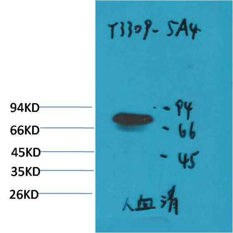 Transferrin Mouse mAb