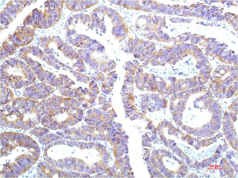 STAT1 (12E8) Mouse mAb