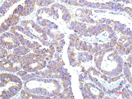 STAT1 (12E8) Mouse mAb