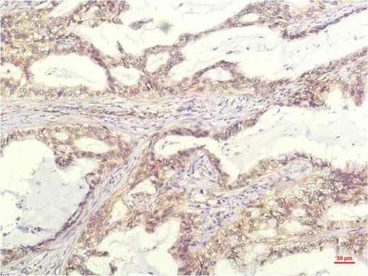 IL-8 (13F8) Mouse mAb