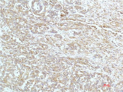 a-actinin (4A12) Mouse mAb 50µL/100µL