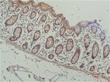 HDAC1 (4E1) Mouse mAb 50µL/100µL
