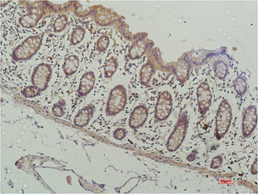 HDAC1 (4E1) Mouse mAb 50µL/100µL