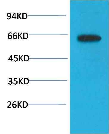 Phospho-Akt (S473) (6F8) Mouse mAb