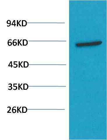 AKT (1H2) Mouse mAb