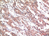 Phospho-Stat3 (Y705) (1E9) Mouse mAb