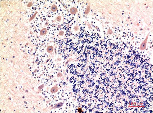 LC3B (9H5) Mouse mAb