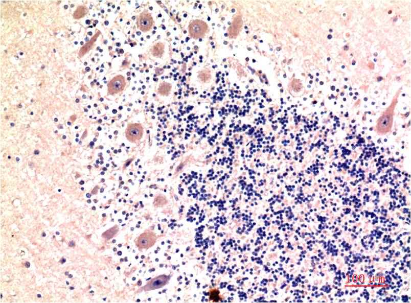 LC3B (9H5) Mouse mAb