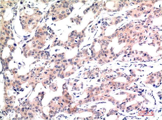 Acetyl-Histone H3 (K9) (2E7) Mouse mAb