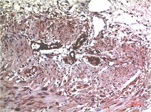 MMP2 (1H1) Mouse mAb