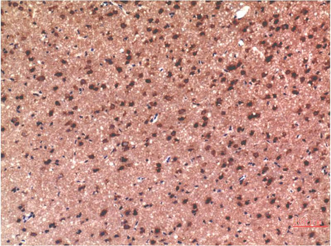 Tau (10E3) Mouse mAb 50µL/100µL