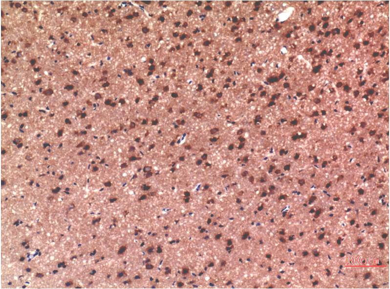 Tau (10E3) Mouse mAb 50µL/100µL