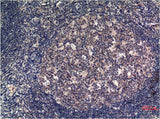 MLKL (8H7) Mouse mAb