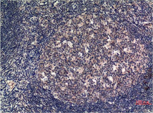 MLKL (8H7) Mouse mAb