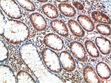 ATM (1D1) Mouse mAb