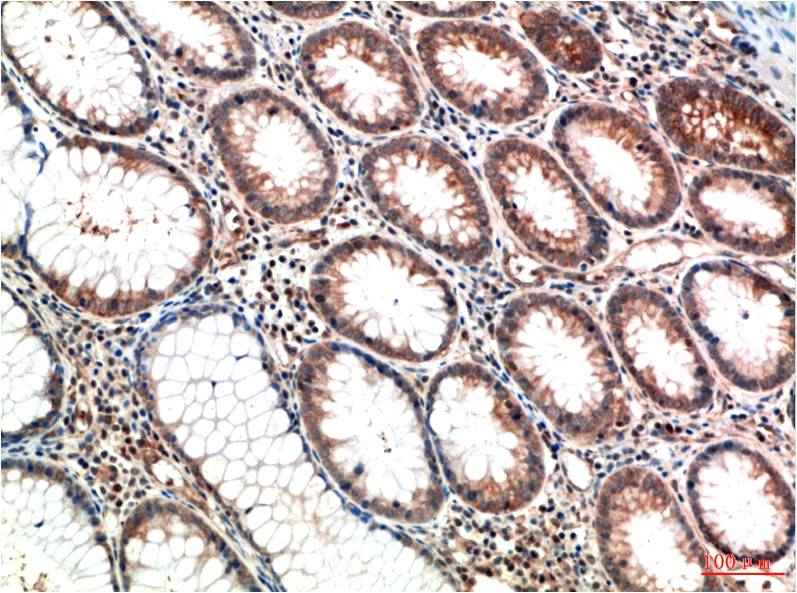 ATM (1D1) Mouse mAb