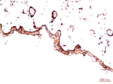 PDGFRα (5D1) Mouse mAb