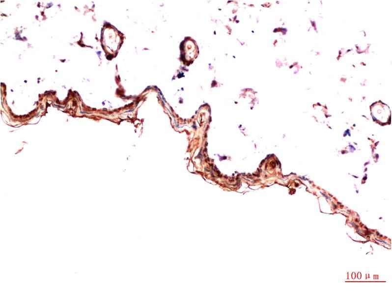 PDGFRα (5D1) Mouse mAb