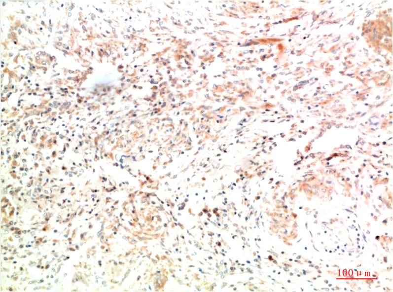 Collagen II (8F6) Mouse mAb