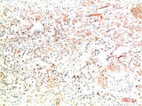 Collagen II (8F6) Mouse mAb