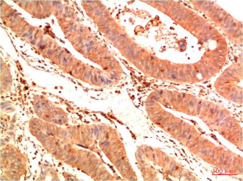 Acetyl P53(K382) (1G7) Mouse mAb