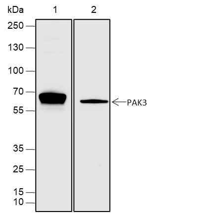 Anti-Human/Rat/Mouse PAK3 Antibody [A320] - ABMIUM