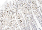 Anti-Human IL33 Antibody [B102] - ABMIUM