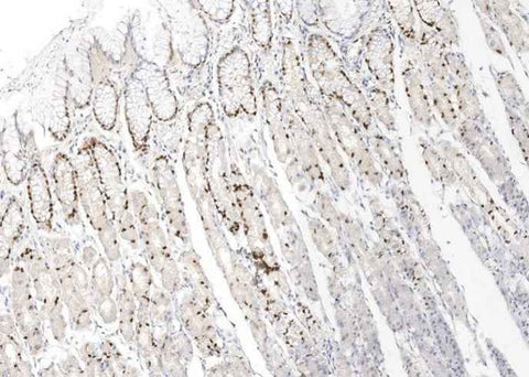 Anti-Human IL33 Antibody [B102] - ABMIUM