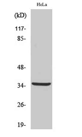 Cleaved-Cathepsin L2 (L114) rabbit pAb