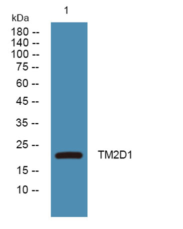 TM2D1 rabbit pAb 50µL/100µL