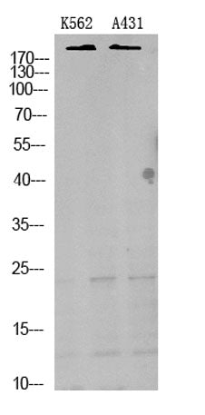TRPM7 rabbit pAb 50µL/100µL