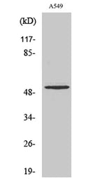 Cleaved-MMP-17 (Q129) rabbit pAb 50µL/100µL