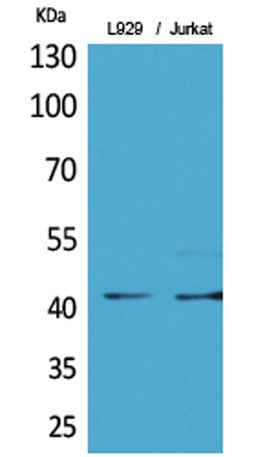 E2F-4 (Acetyl Lys96) rabbit pAb