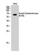 Cytokeratin-pan (Acetyl Lys194) rabbit pAb