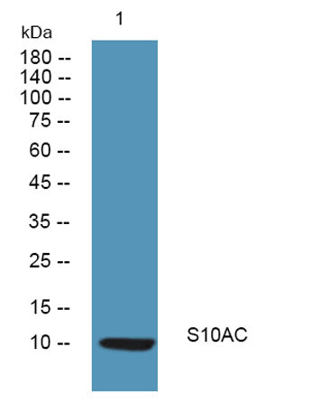S10AC rabbit pAb 50µL/100µL